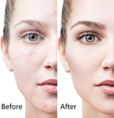 6 - in - 1 Derma Roller System - Zambeel