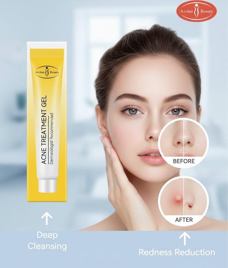 Aichun Beauty - Acne Treatment Gel - Zambeel
