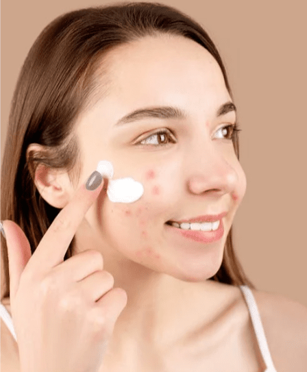 Aichun Beauty - Acne Treatment Gel - Zambeel