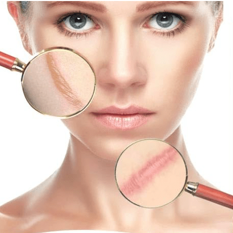 Aichun Beauty - Scar Removal Gel - Zambeel