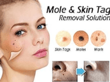 Aichun Beauty - Tag & Wart Removal Cream - Zambeel