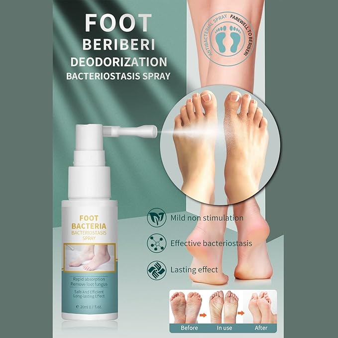 Ansiyi - Foot Bacteria Bacteriostasis Spray (Original) - Zambeel