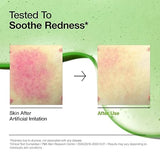 Anua - Azelaic Acid 10 + Hyaluron Redness Soothing Serum (Original) - Zambeel