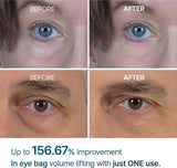 Dr Melaxin Eyephalt Eyecream - Zambeel