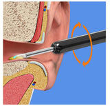 Earwax Removal Kit - Zambeel