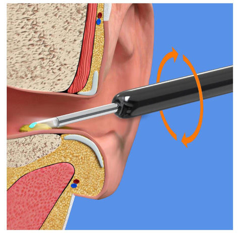 Earwax Removal Kit - Zambeel