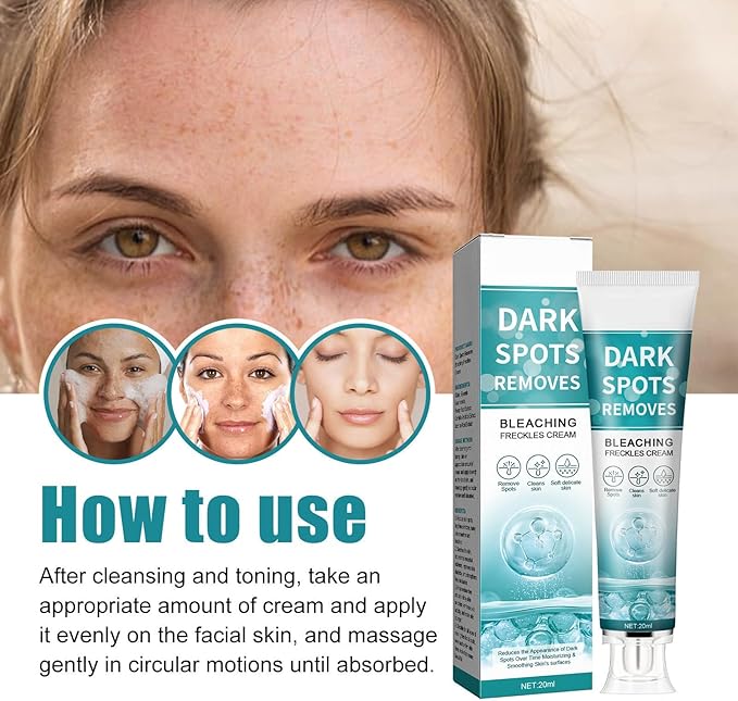 Eelhoe - Dark Spots Removes Cream (Original) - Zambeel