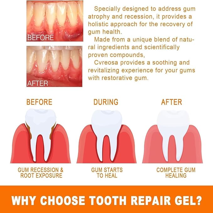 Eelhoe - Gum Repair Essence Ampoules - Zambeel