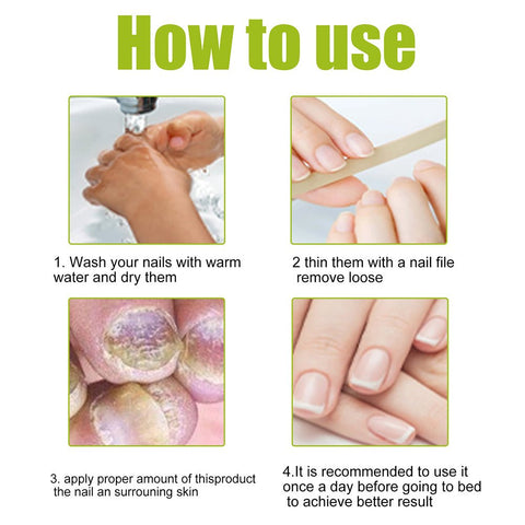 EELHOE - Nail Treatment Repair Gel - Zambeel
