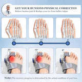 FeetifFix - Bunion Corrector - Zambeel