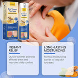 HOUKEA - Bee Venom Psoriasis Soothing Spray (Original) - Zambeel