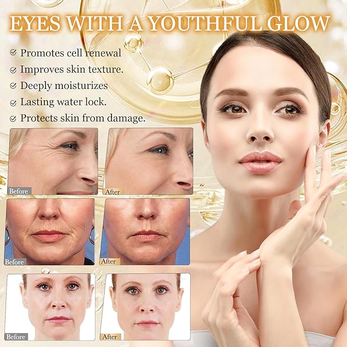 Hoygi - Retinol & Bee Venom Line Capsules (Original) - Zambeel