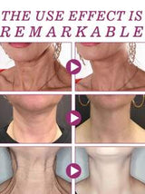 Jaysuing - Hydrolyzed Collagen Neck Cream - Zambeel