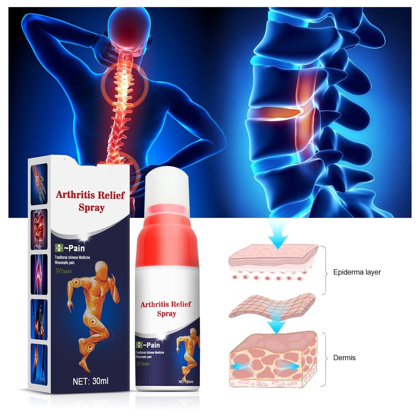 Lumbar Leg Joint Discomfort Relief Spray Joint Cold Compress Lotion - Zambeel