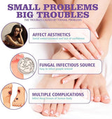 Nail Fungus Spray - Zambeel