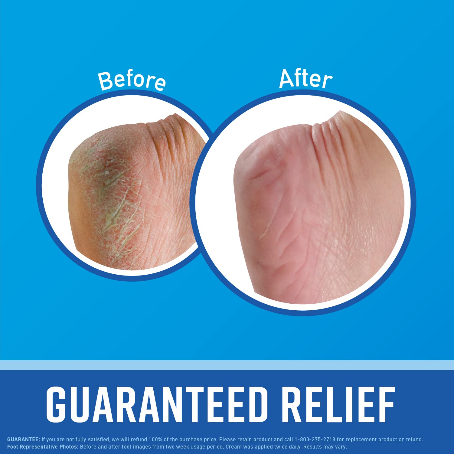 O’Keeffe’s - Healthy Feet Cream - Zambeel