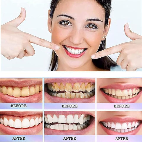 Oralhoe - Nicotinamide Dazzle White Toothpaste (Original) - Zambeel