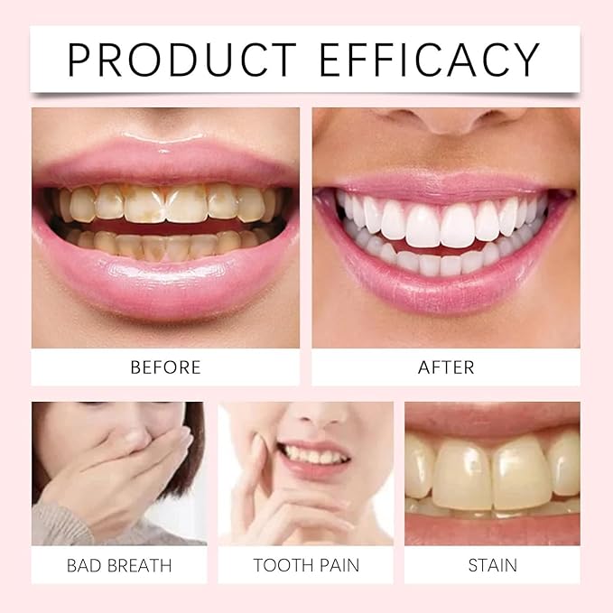 Oralhoe - Nicotinamide Dazzle White Toothpaste (Original) - Zambeel
