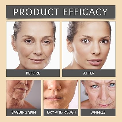 OUHOE - Bee Venom Botox Wrinkle Cream (Original) - Zambeel