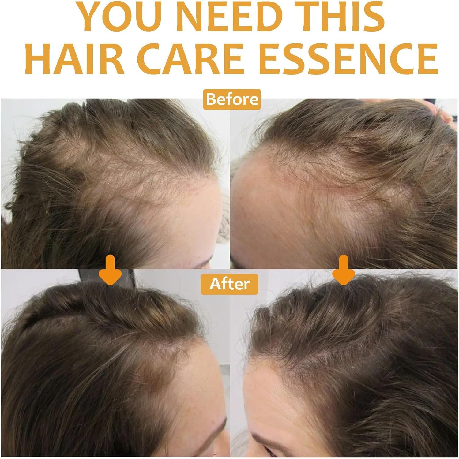 OUHOE - Biotin Hair Growth Serum - Zambeel