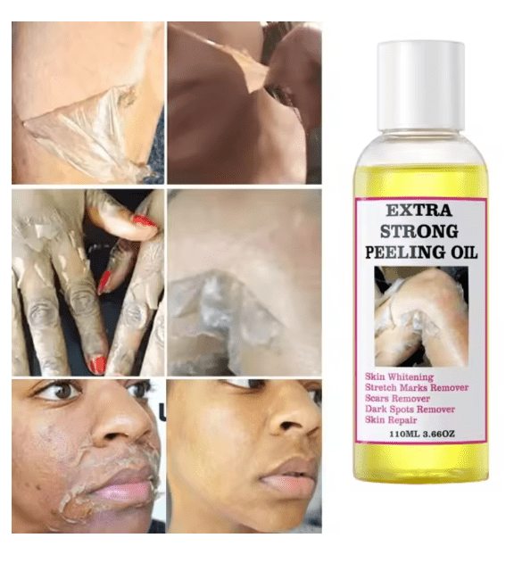 Peeling Oil (110ml) - Zambeel
