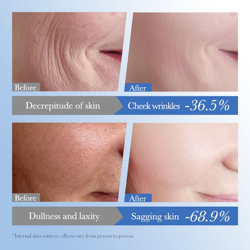SADOER - Caviar Hyaluronic Acid Anti - Aging Repair Moisturizing Cream - Zambeel