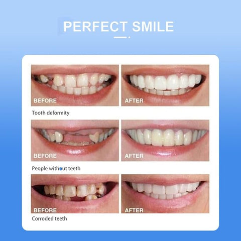 Snap On Smile - Snap On Smile - Zambeel
