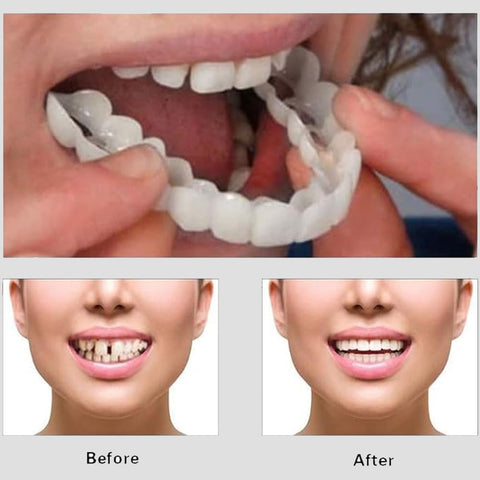 Snap On Smile - Snap On Smile - Zambeel