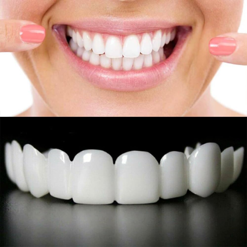 Snap On Smile - Snap On Smile - Zambeel