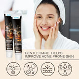 Snmifun - Bee Anti - Acne Gel - Zambeel