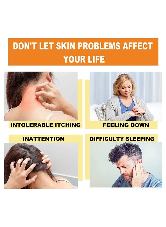 South Moon - Bee Venom Psoriasis Care Cream - Zambeel