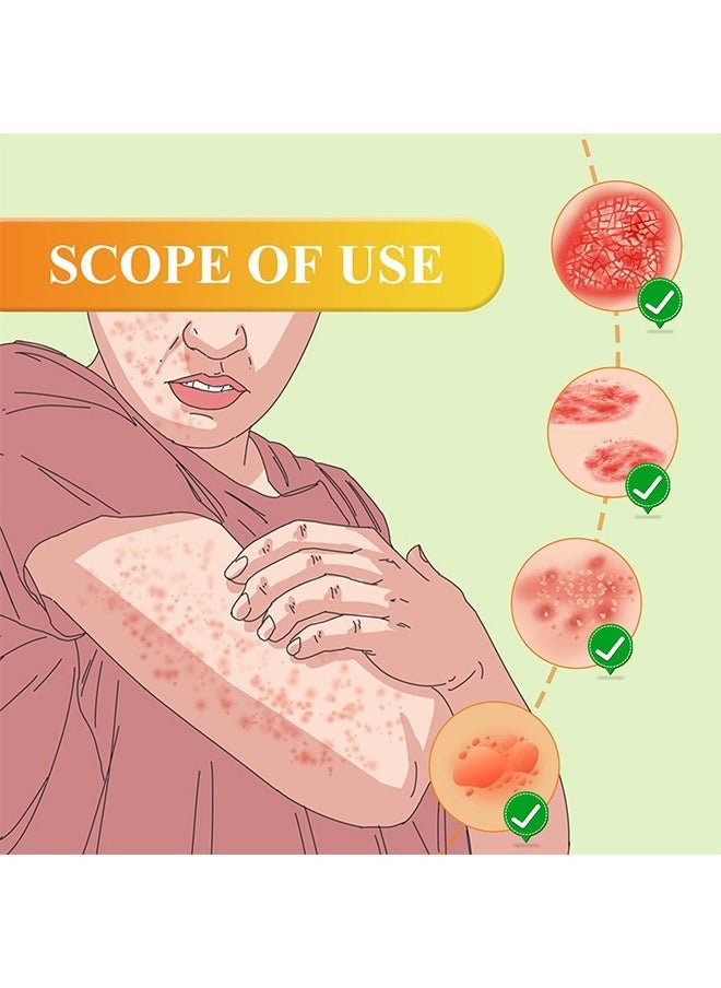 South Moon - Bee Venom Psoriasis Care Cream - Zambeel