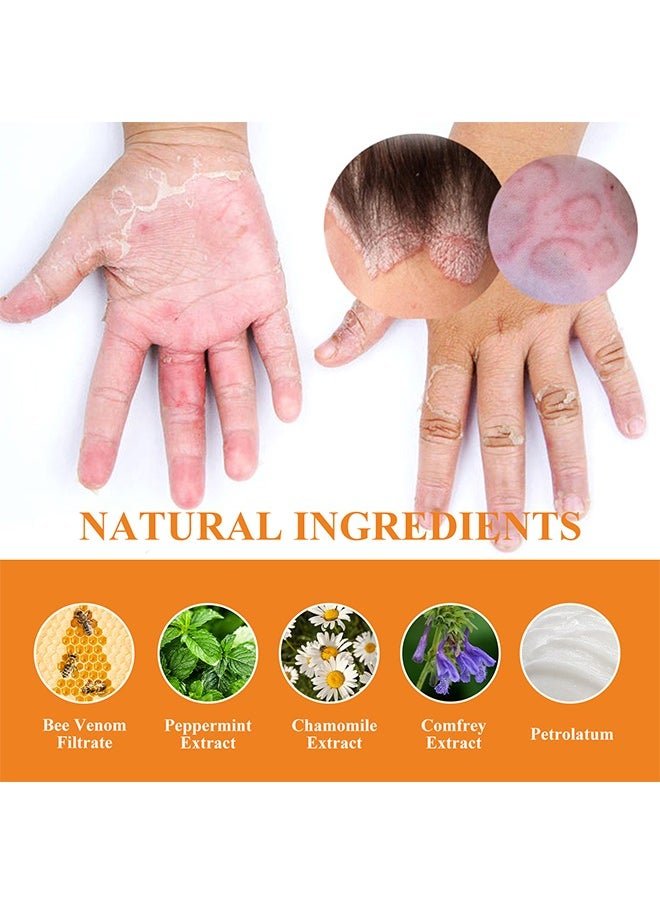 South Moon - Bee Venom Psoriasis Care Cream - Zambeel