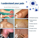 South Moon - Lipoma Removal Spray - Zambeel