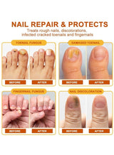 Sumifun - Bee Venom Fungal Nail Treatment Cream (Original) - Zambeel