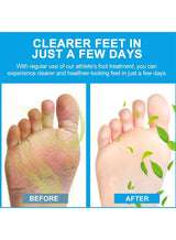 Sumifun - Foot Anti - Bacterial Cream (Original) - Zambeel