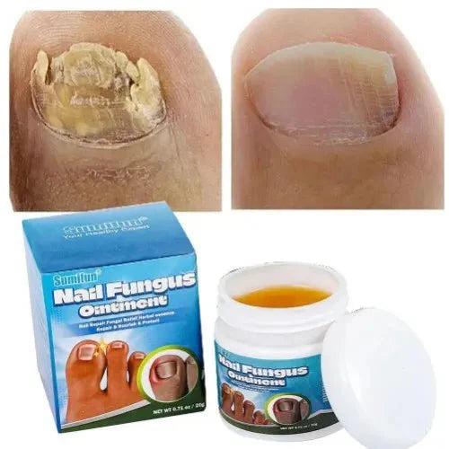 Sumifun - Nail Fungus Ointment (Original) - Zambeel