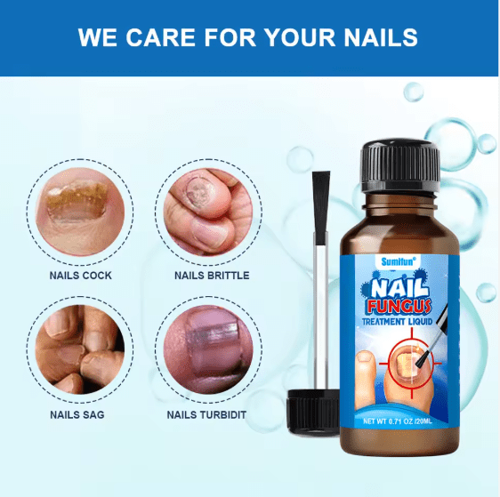 Sumifun - Nail Fungus Treatment Liquid (Original) - Zambeel