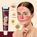 Sumifun - Rosacea Relief Ointment (Original) - Zambeel