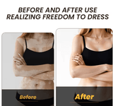 Sumifun - Vitamine Vitiligo Cream (Original) - Zambeel