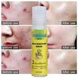 Temulawak - New Acne Removing Serum (Original) - Zambeel