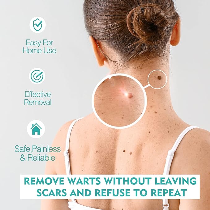 West & Month - Skin Tag Remover - Zambeel